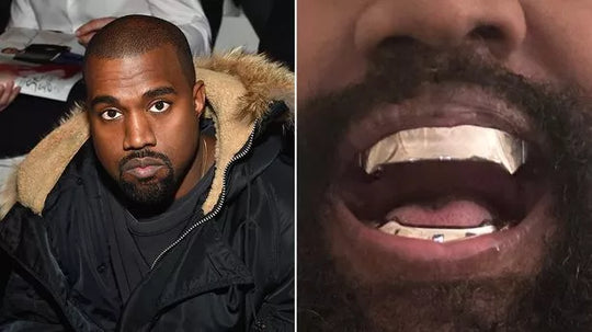 Kanye West Grillz - Complete Guide on Cost and Designs