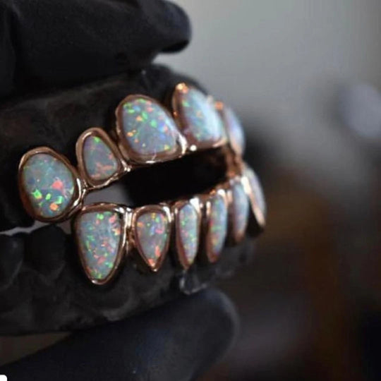 Guide to Custom Opal Grillz - Where to Buy, Cost, Colors