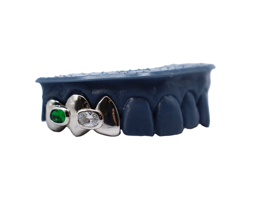 3 Tooth Emerald Cut Diamond and Emerald Gap Filler Grillz White Gold