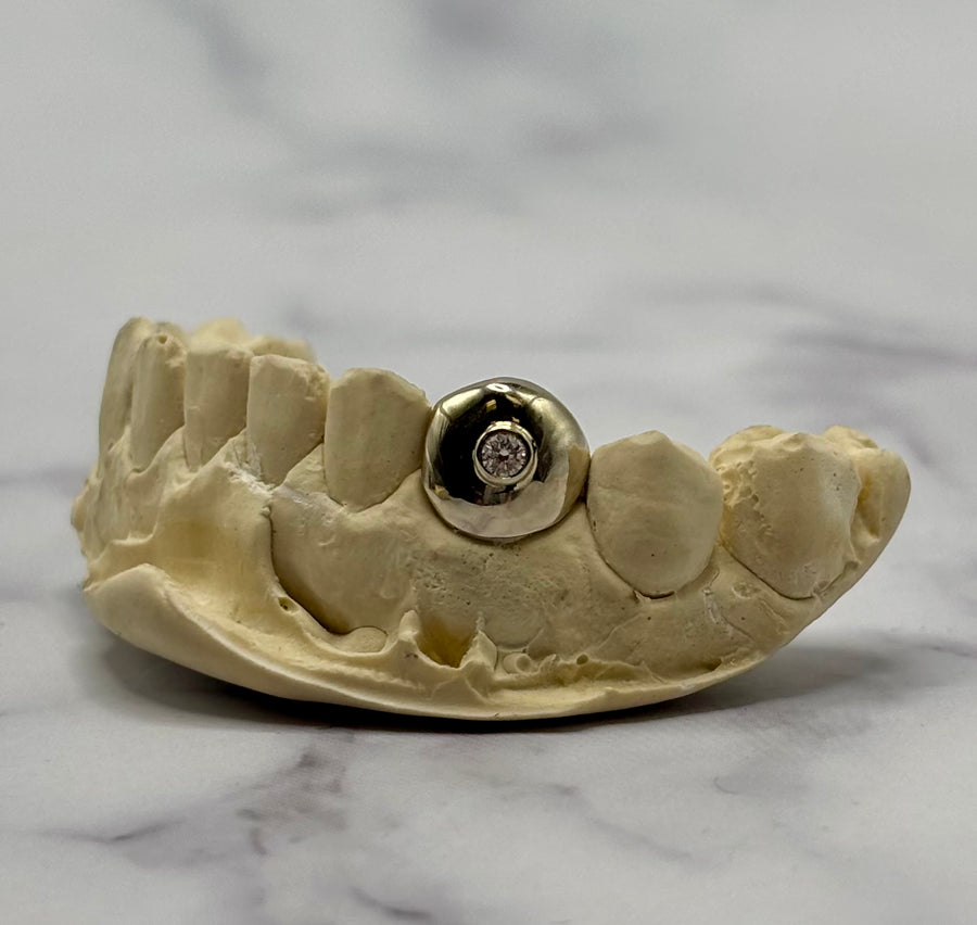 Bezel Set Single Stone (One Tooth)