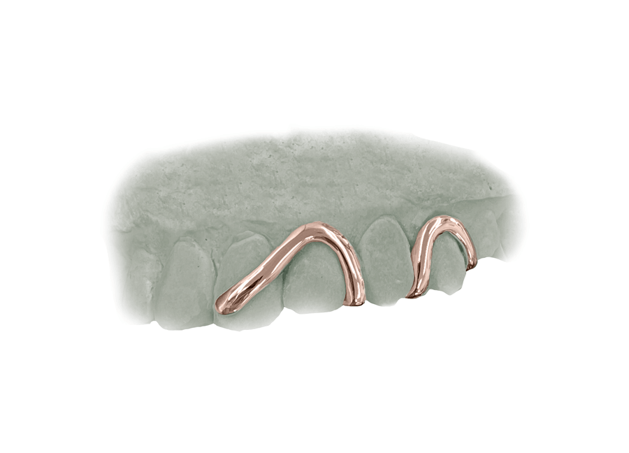 Top Wave Grillz (10K, Rose Gold)