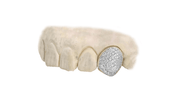 VVS Diamond Tooth Single Cap 14K Yellow Gold